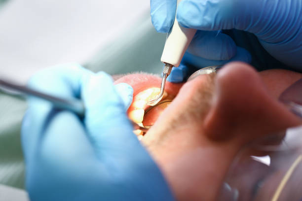Best Root Canal Emergency Dentist  in Rose Lodge, OR