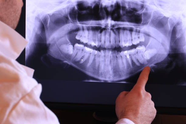 Best Chipped Tooth Repair Near Me  in Rose Lodge, OR