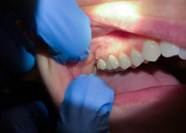 Best Emergency Gum Pain Relief  in Rose Lodge, OR
